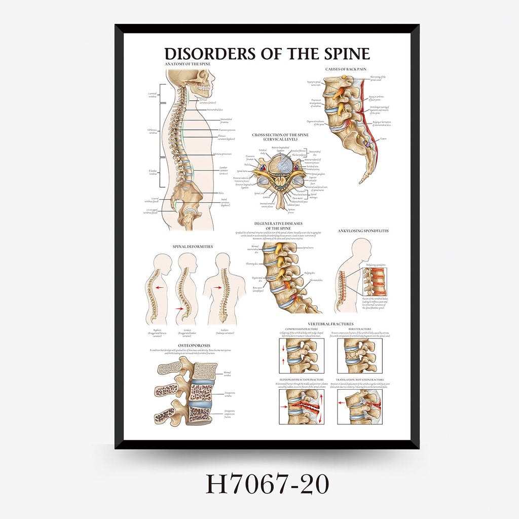 Human Anatomy Muscles Wall Chart