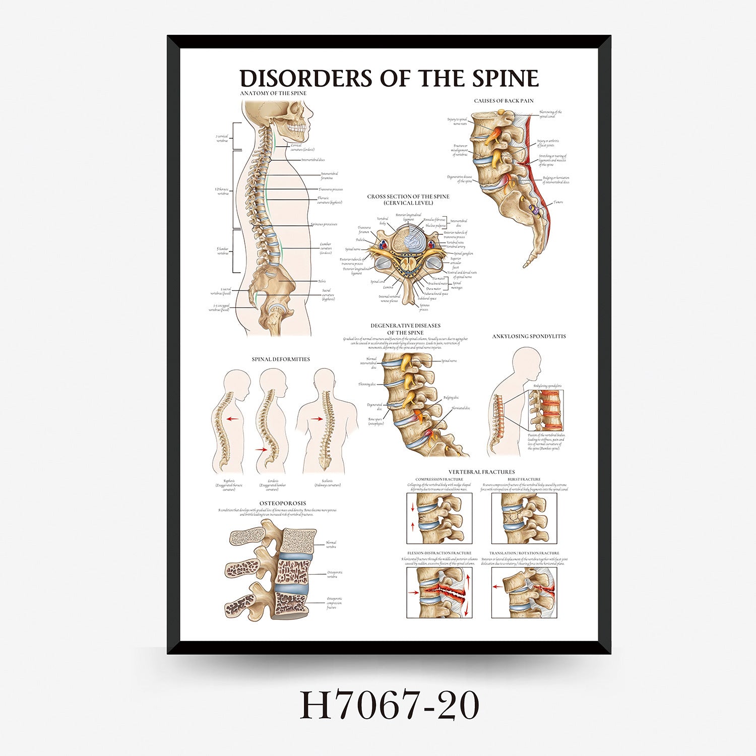 Human Anatomy Muscles Wall Chart
