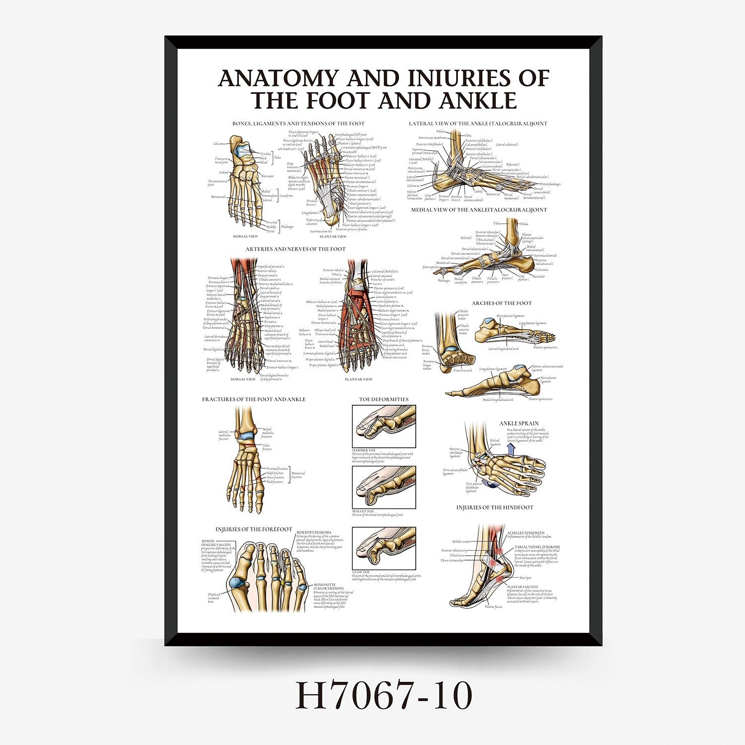 Human Anatomy Muscles Wall Chart